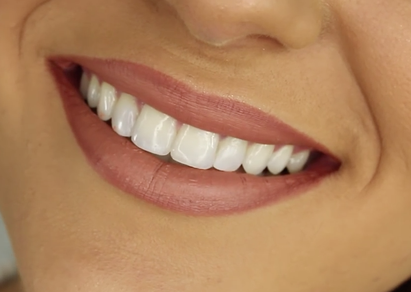 Transform Your Smile with Affordable Cosmetic Dentistry from Jones Family Dental